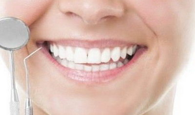 箍牙齿期间需要注意什么