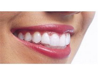 牙龈出血牙齿酸是什么问题(牙龈出血牙齿松动什么原因)