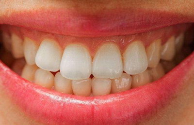 牙齿有洞怎么治疗牙周炎_牙周炎导致牙齿脱落怎么治疗