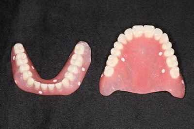 牙贴片什么牌子的好_牙套和牙贴片有什么区别