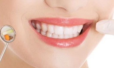 牙齿上有牙斑是怎么回事「牙齿上有一个小黑点是怎么回事」