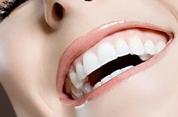 牙齿矫正需要注意什么