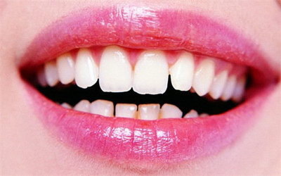 洗牙能不能改善牙龈出血(牙龈出血能不能洗牙)