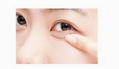 杭州双眼皮医生排名「杭州双眼皮哪个医生做的最好」