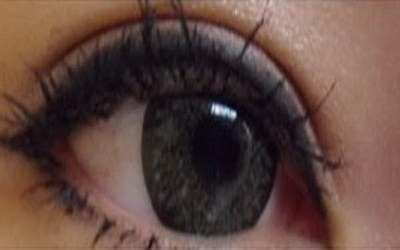 双眼皮手术后的注意事项有哪些
