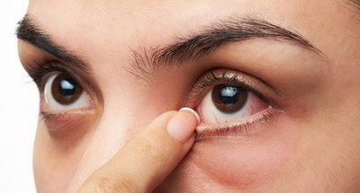 双眼皮有点大小眼怎么办_双眼皮有点肿是什么原因
