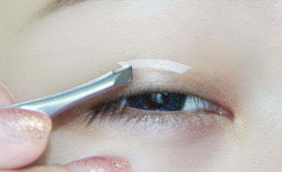 哺乳期做埋线双眼皮手术多久可以喂奶_哺乳期做埋线双眼皮喂奶了没事吧