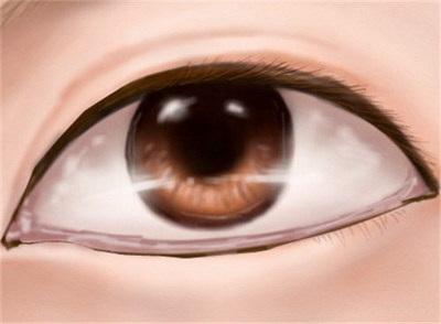 做近视眼手术没有副作用吗_关于做近视眼手术的利与弊