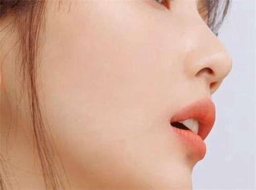 2023年黔西南贞丰县鼻尖修复注射隆鼻哪个医生比较厉害